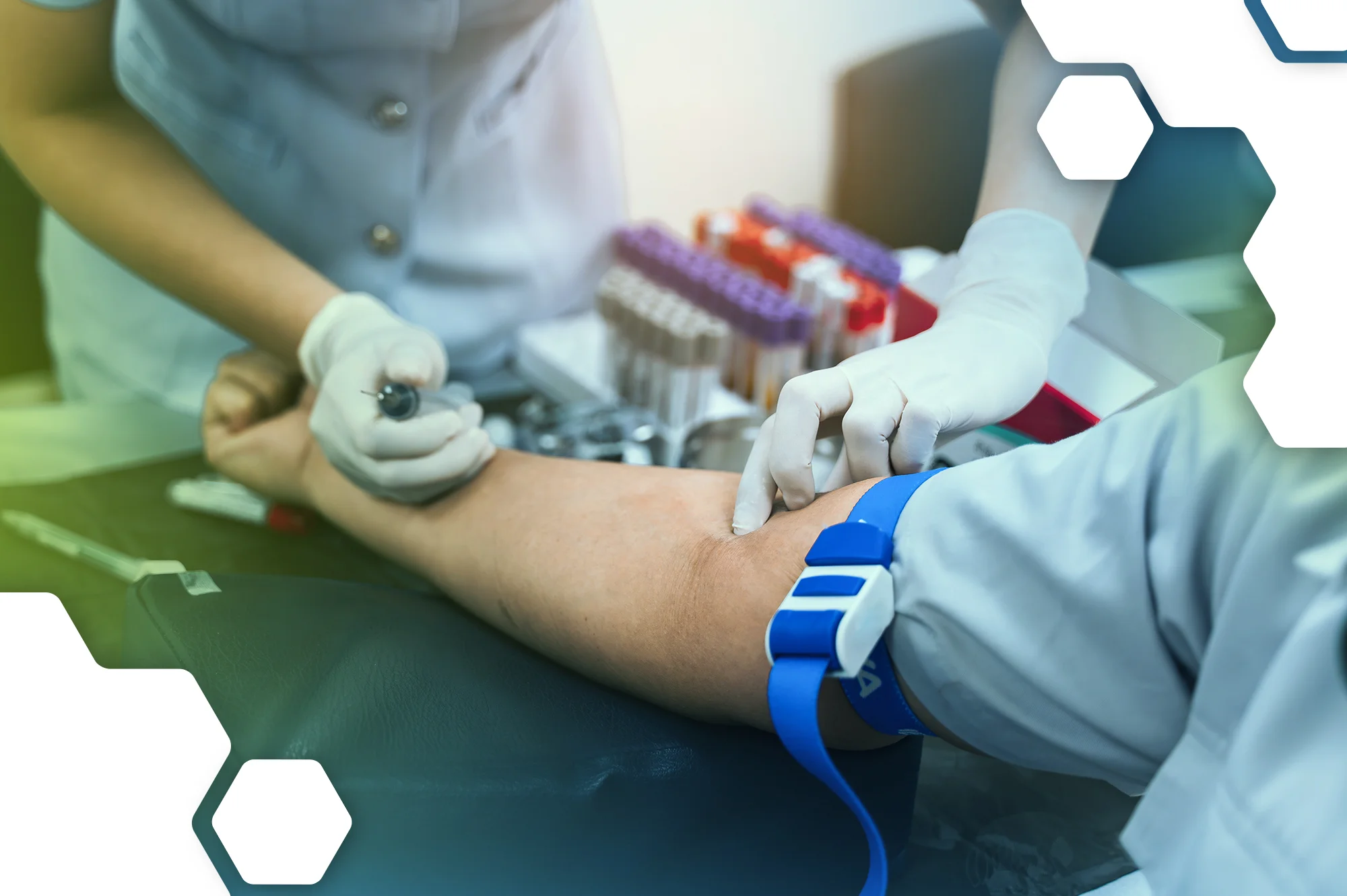 exames laboratoriais